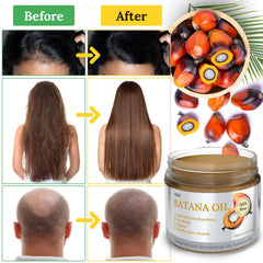 Dr. Sebi 100% Natural, Unrefined and Organic Batana Oil from Honduras for Hair Growth - Enhances Hair Thickness, Prevents Loss for Men & Women